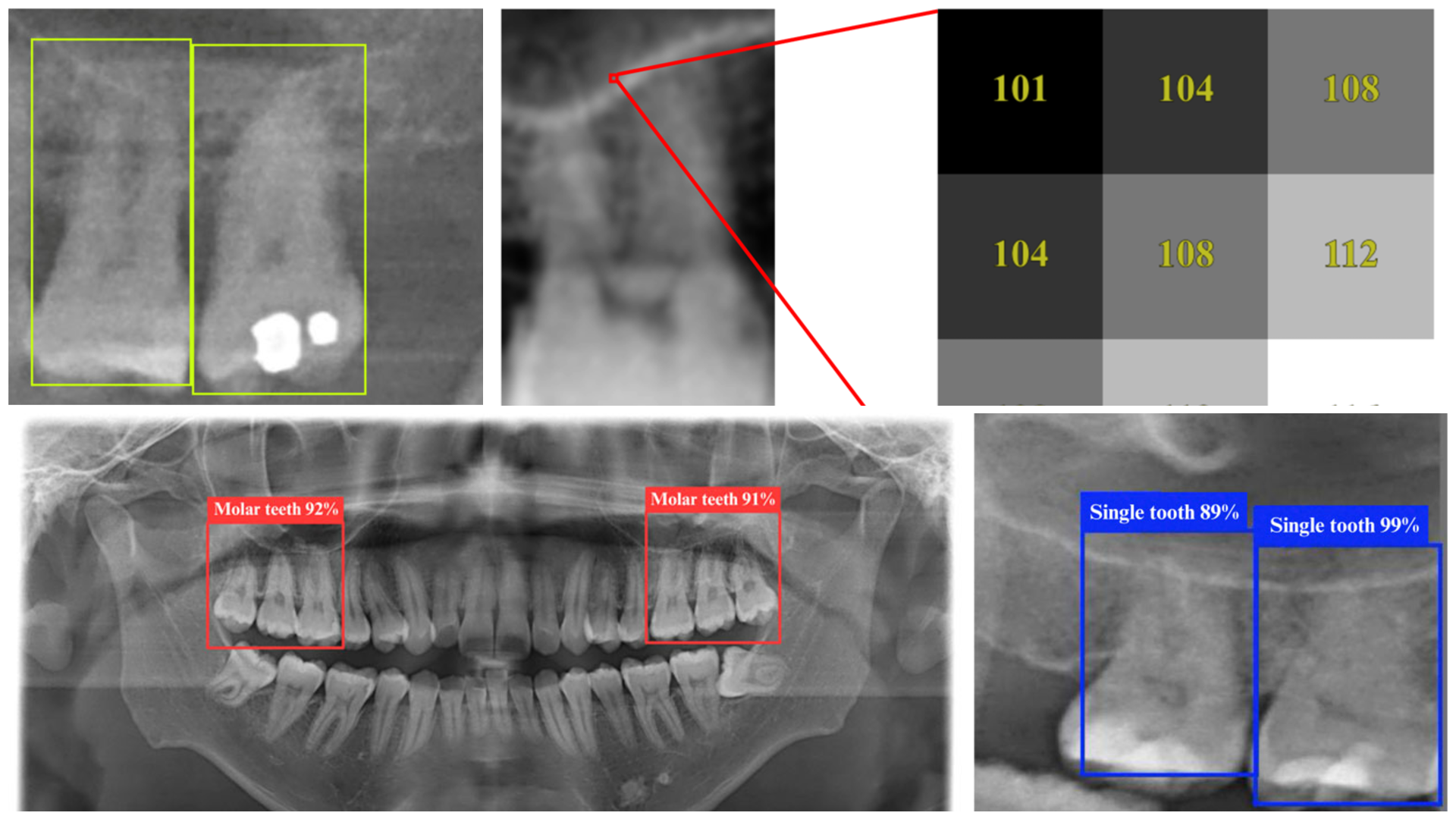 AI Revolutionizes Dentistry